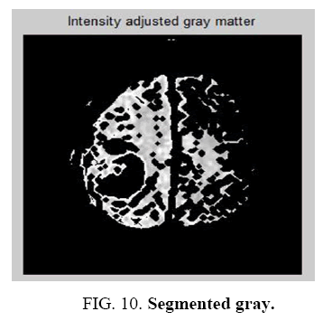 biotechnology-Segmented-gray
